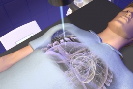CyberKnife pracuje s přesností na dva milimetry.