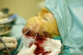 Třetina lid&iacute;, kteř&iacute; jdou na estetickou operaci, si nepřipou&scaron;t&iacute; rizika.