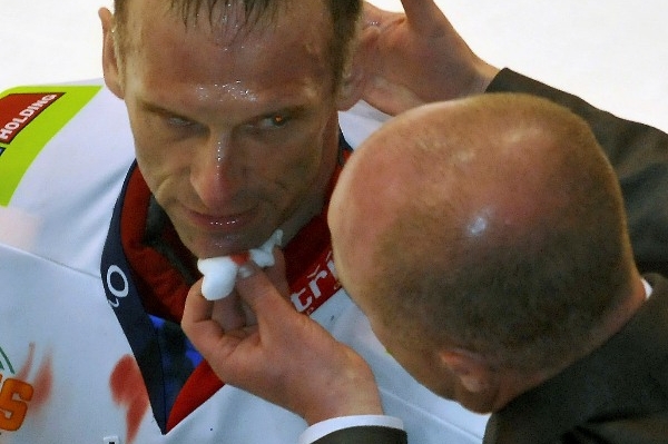 Dominik Hašek musel jít po utkání na šití.