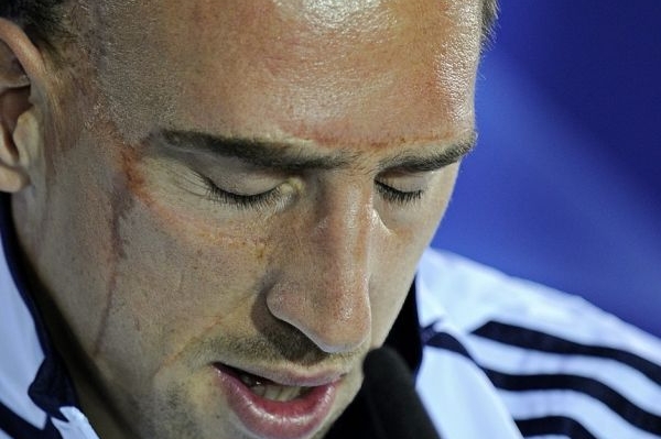 Franck Ribéry. 
