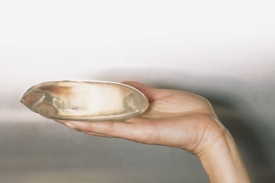 Běžný implantát stojí mnohem méně peněz než nová metoda.