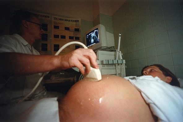 Podle britských vědců není plod v děloze při vědomí.