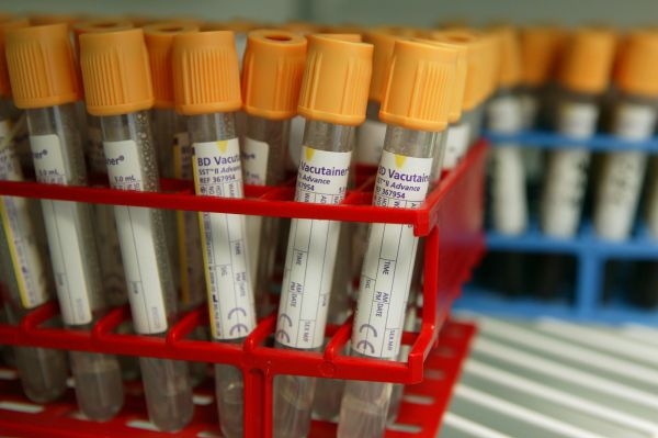 Pandemie byla hlavně výkřikem farmaceutických koncernů.