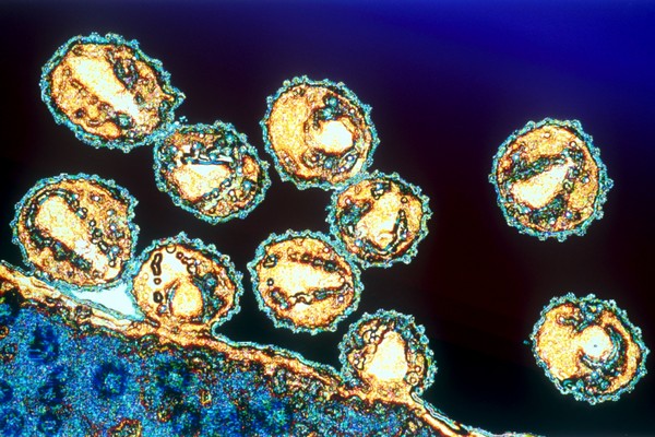 Nově vytvořené viry HIV unikají z infikované buňky.