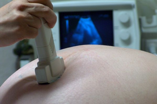Muži nabízejí na webu své sperma ženám, které chtějí otěhotnět a nemají partnera nebo s ním nemohou přijít do jiného stavu.