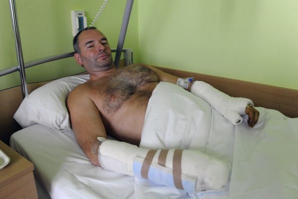 Výpravčímu Danielu Petrovi lékaři operovali komplikovanou zlomeninu ruky. 