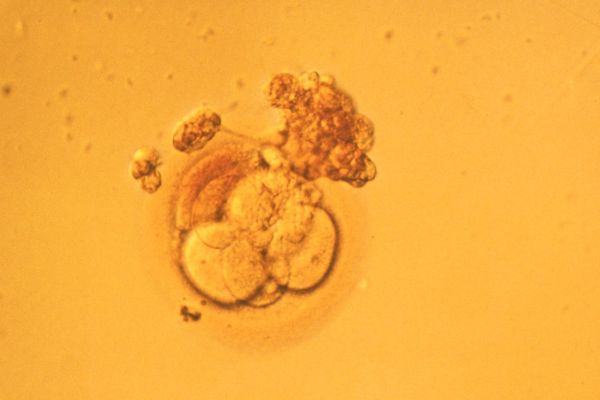 Oplodnění in vitro vyvolává mezi Poláky vášnivé debaty.