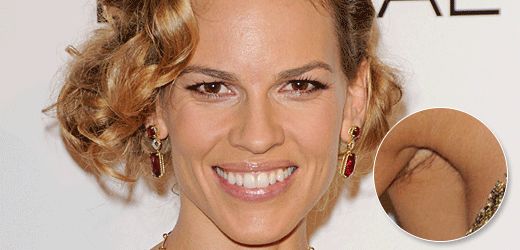 Hilary Swanková si zapomněla oholit podpaždí.