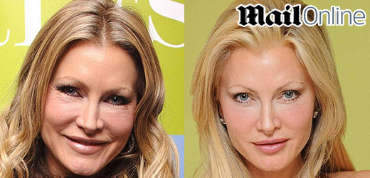 Modelka Caprice v současné době (vlevo) a před rokem na jaře.