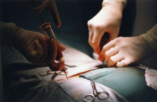 Transplantace zachrání ročně život šesti stům lidí. 