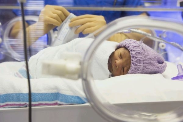 Nedonošené miminko váží od půl kilogramu do dvou a půl kilogramu.