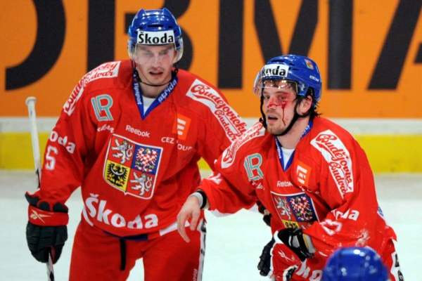 Petr Koukal (vpravo) měl obrovské štěstí, že nepřišel o oko.