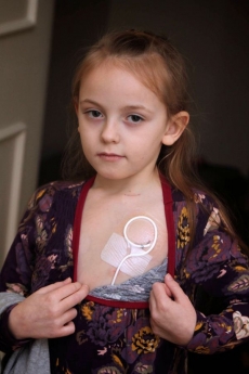 Daisy může jíst jen pomocí této hadičky, kterou má zavedenou do žil.