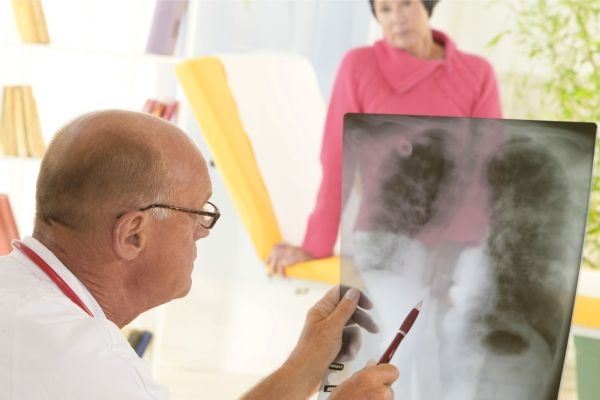 Rakovina plic a hrtanu by mohla brzy patřit k nemocem z povolání (ilustrační foto). Rakovina plic a hrtanu by mohla brzy patřit k nemocem z povolání (ilustrační foto).