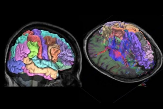 Atlas nabízí detailní snímky anatomie mozku a informace o aktivitě jednotlivých genů.