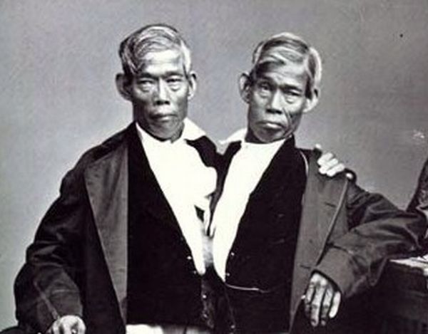 Nejznámější dvojčata v historii - Eng a Chang Bunkerové.