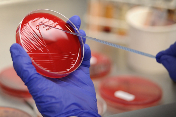 Laboratorní asistent z univerzitní nemocnice v Hamburku drží Petriho misku, která obsahuje bakterii Escherichia coli (EHEC). Laboratorní asistent z univerzitní nemocnice v Hamburku drží Petriho misku, která obsahuje bakterii Escherichia coli (EHEC).