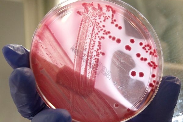 Bakterie ze španělských okurek nejsou, zdá se, původcem epidemie průjmu v Německu.