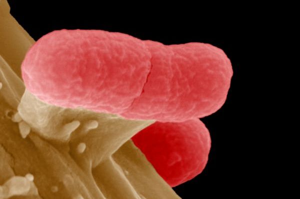 Bakterie E. coli.