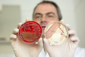 E. coli zmutovala do nebezpečnější varianty.