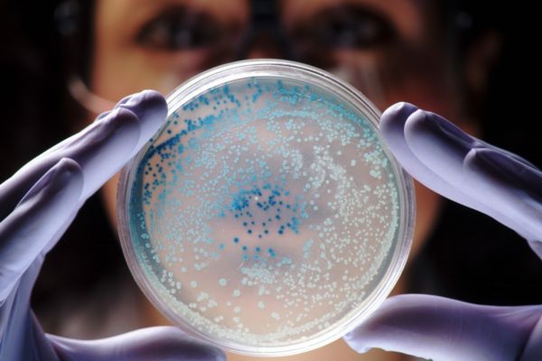 Bakterie E.coli. Bakterie E.coli.