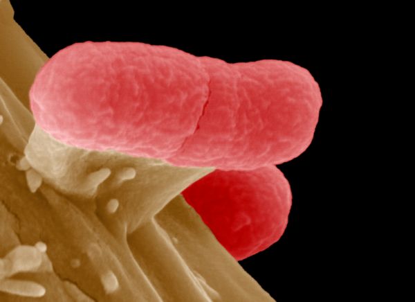 Bakterie E. coli pod mikroskopem.