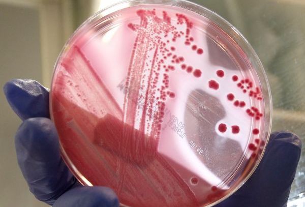 Nebezpečná střevní bakterie E.coli. Nebezpečná střevní bakterie E.coli.