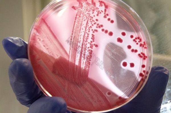 Smrtící bakterie E.coli.