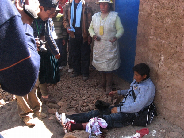 Při protestech proti těžbě na jihu Peru již zahynulo několik lidí a mnoho dalších bylo zraněno (ilustrační foto). Při protestech proti těžbě na jihu Peru již zahynulo několik lidí a mnoho dalších bylo zraněno (ilustrační foto).