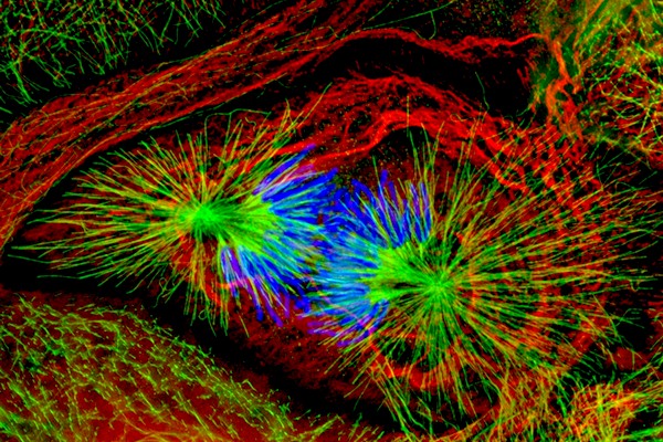 Fluorescenční metody umožňují studovat procesy probíhající v buňkách, zde dělení buněčného jádra. Fluorescenční metody umožňují studovat procesy probíhající v buňkách, zde dělení buněčného jádra.