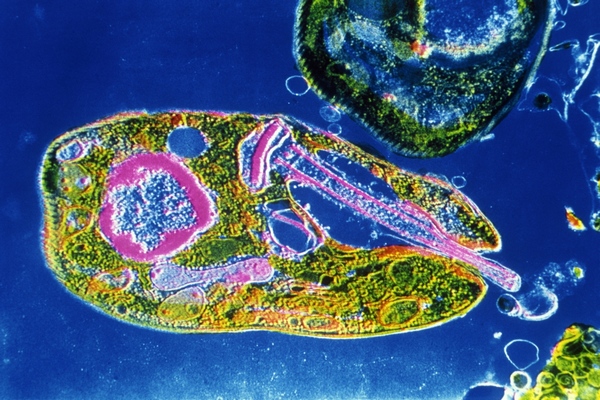 Leishmania se svými chromozomy čaruje způsobem, který by jiné organismy spolehlivě zabil.