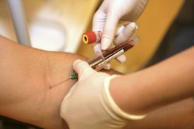 Pražský Dům světla tento týden poskytne testování na vir HIV zdarma.