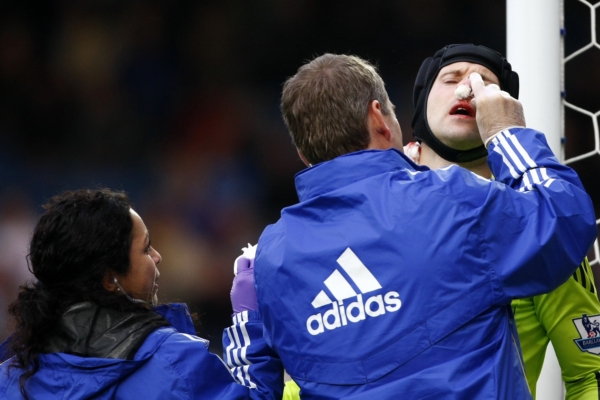 Gólman Petr Čech poté, co utrpěl zlomeninu nosu.