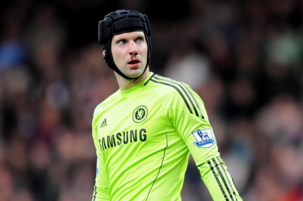 Petr Čech se zlomeným nosem na operaci nemusí. Petr Čech se zlomeným nosem na operaci nemusí.