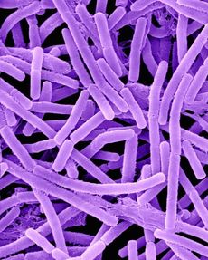 Spory antraxu, které experti označují za prototyp smrtící biologické zbraně, přežívají v půdě kolem 50 let (ilustrační foto).