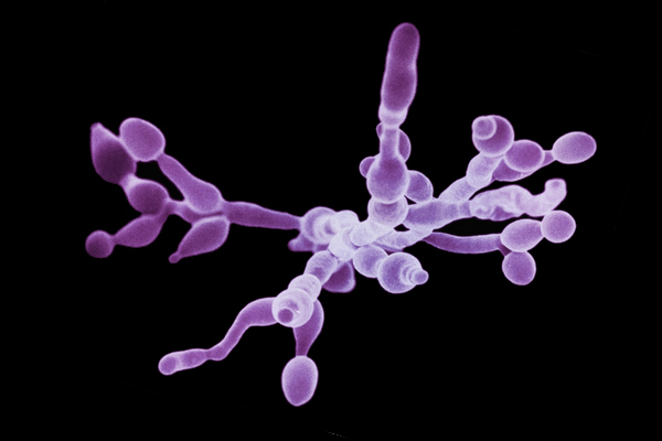 Jinak zdravého člověka kvasinky příliš nepotrápí, u HIV pozitivního ale mohou způsobit vážné komplikace.