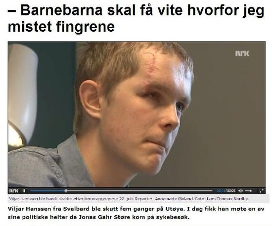 Viljar Hanssen přišel o oko a několik prstů (repro z televize NRK). Viljar Hanssen přišel o oko a několik prstů (repro z televize NRK).
