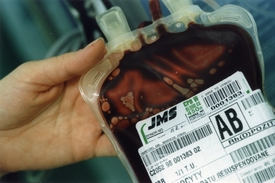 Testy na HIV už dnes netrvají měsíce, nýbrž dny.