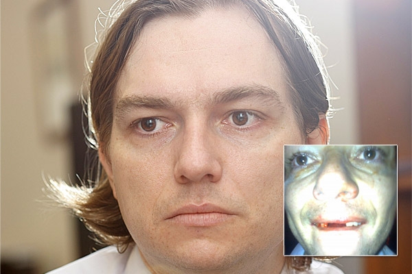 Napadený poslanec Michal Babák. Napadený poslanec Michal Babák.