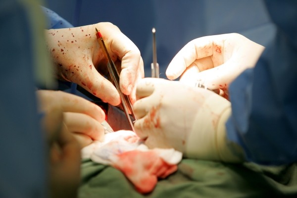 Velká jizva je často důvod, proč lidé operaci srdce odkládají, tvrdí lékaři. Velká jizva je často důvod, proč lidé operaci srdce odkládají, tvrdí lékaři.