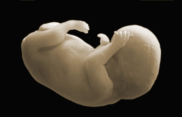 Nalezená lidská embrya pocházejí z vědeckého pokusu (ilustrační foto). Nalezená lidská embrya pocházejí z vědeckého pokusu (ilustrační foto).