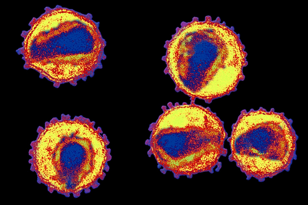 Protivirové léky nedovedou HIV zlikvidovat beze zbytku. Některé se dovedou v buňkách schovat.