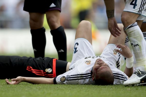 Zraněný Pepe. Zraněný Pepe.