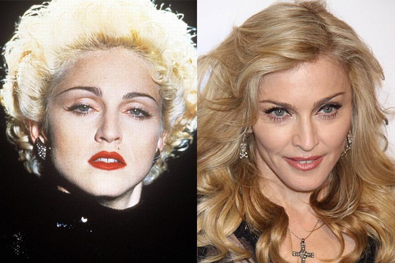 Madonna na nedatovém archivním snímku (vlevo) a dnes. I této zpěvačce přibyly vrásky, ale možná díky péči plastických chirurgů vypadá mnohem lépe než kdysi. Madonna na nedatovém archivním snímku (vlevo) a dnes. I této zpěvačce přibyly vrásky, ale možná díky péči plastických chirurgů vypadá mnohem lépe než kdysi.