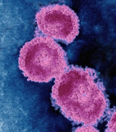 Coronavirus, patogen SARS.