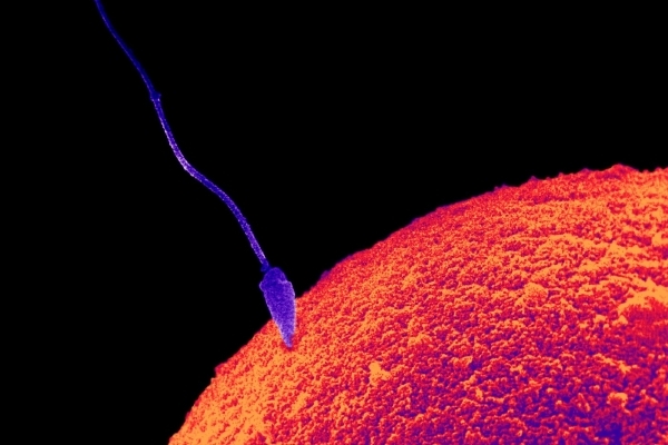 Jak se spermie pohybuje, rozhoduje o tom, zda se dostane k vajíčku jako první. Některé spermie si zřejmě razí rovnější cestu než jiné. Jak se spermie pohybuje, rozhoduje o tom, zda se dostane k vajíčku jako první. Některé spermie si zřejmě razí rovnější cestu než jiné.