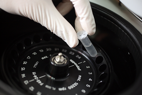 Expertům do pražského kriminalistického ústavu poslali ke srovnání profil DNA izolované z kosterních ostatků a profil DNA syna pohřešované. Expertům do pražského kriminalistického ústavu poslali ke srovnání profil DNA izolované z kosterních ostatků a profil DNA syna pohřešované.