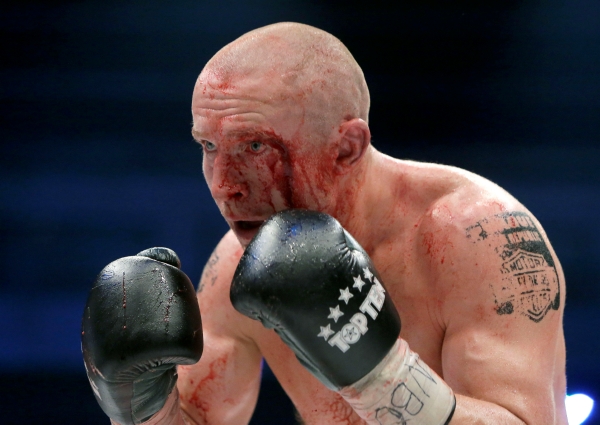 Boxer Lukáš Konečný dokončil souboj o pás mistra světa se zraněním v obličeji. Boxer Lukáš Konečný dokončil souboj o pás mistra světa se zraněním v obličeji.