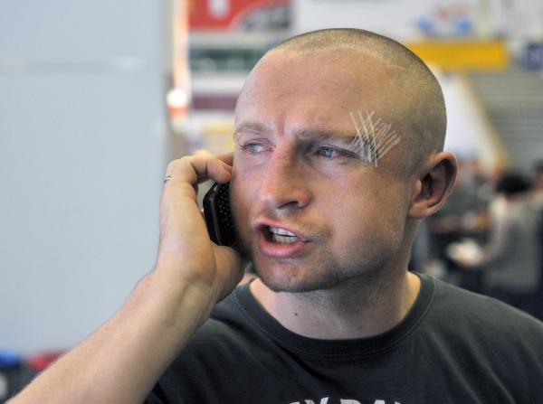 Boxer Lukáš Konečný dokončil souboj o pás mistra světa se zraněním v obličeji.