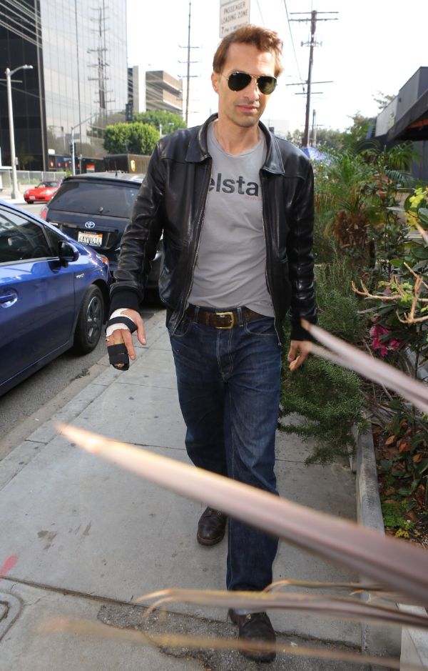 Olivier Martinez ukázal zraněnou ruku.